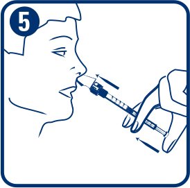 Aluneb Dispositivo de Nebulización Nasal 